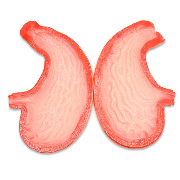 Модель «Желудок человека» Модель «Желудок человека»